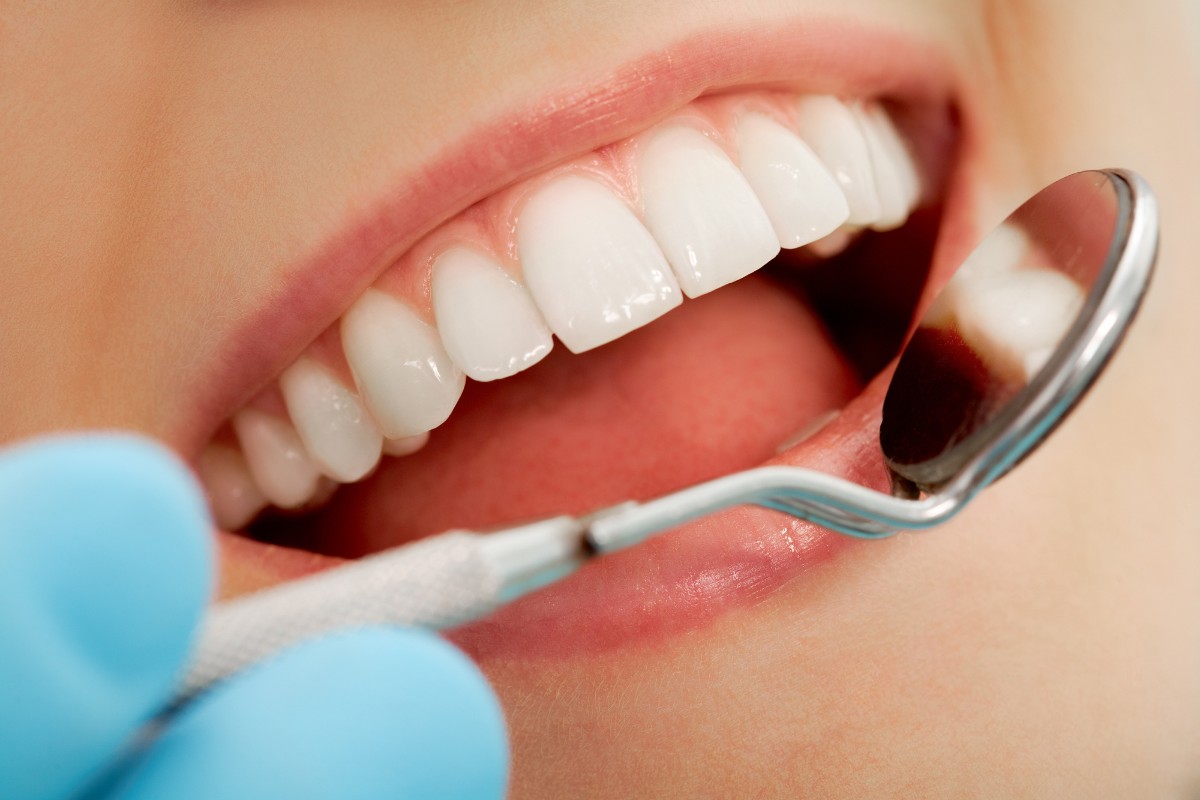 Hvide tænder ved tandlægen